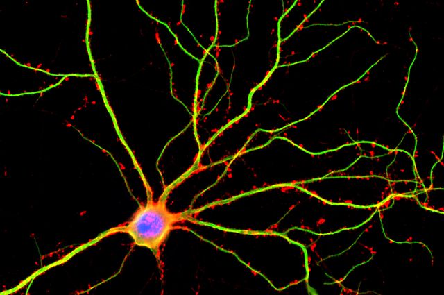 Neuron_mid